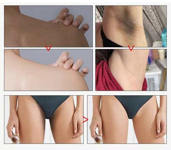 КРЕМ ПРОТИ РОЗТЯЖОК НА ТІЛІ