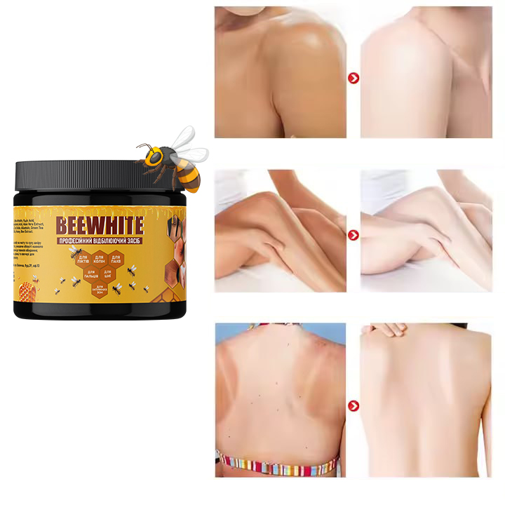 КРЕМ ПРОТИ РОЗТЯЖОК НА ТІЛІ