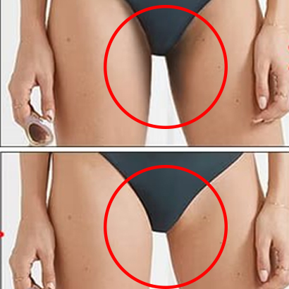 КРЕМ ПРОТИ РОЗТЯЖОК НА ТІЛІ