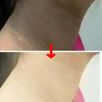 КРЕМ ПРОТИ РОЗТЯЖОК НА ТІЛІ