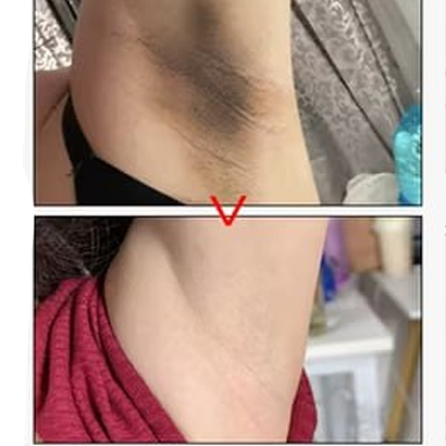 КРЕМ ПРОТИ РОЗТЯЖОК НА ТІЛІ